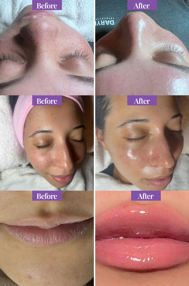 Clean, professional medical spa treatment room with neutral tones at Pink Beauty Med Spa in Houston